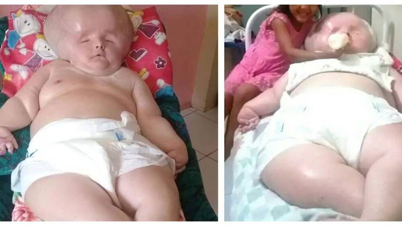 Salvador tiene 2 años, padece una inusual enfermedad y sus padres