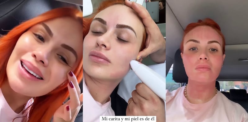 Sara Uribe mostró cómo quedó después después de someterse a un tratamiento de belleza