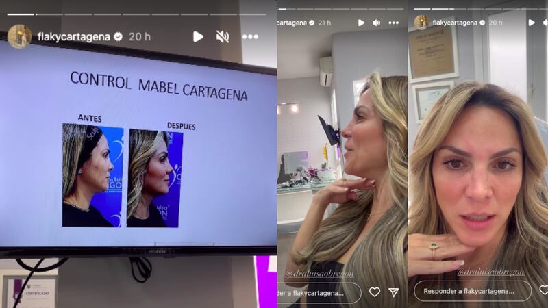 Mabel Cartagena compartió el antes y después de su rostro